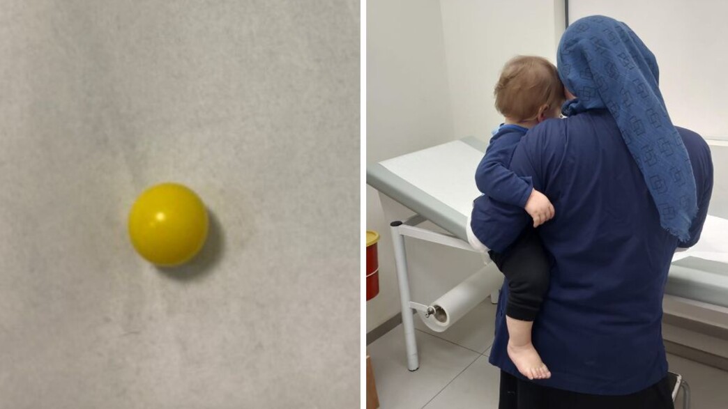 Beitar Illit: The exceptional procedure performed by the doctor saved the infant’s life.